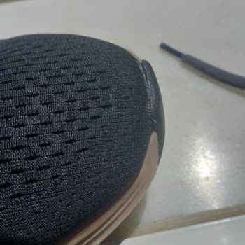 Skechers Ayakkabı Sorununa İlgisizliği