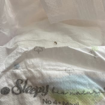 Sleepy Bio Natural Bebek Bezinin İlk Katmanından Sert Cisim Çıktı.