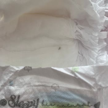 Sleepy Bio Natural Bebek Bezinin İlk Katmanından Sert Cisim Çıktı.