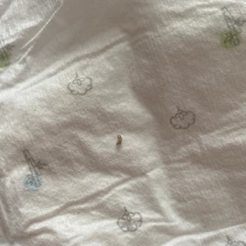 Sleepy Bio Natural Bebek Bezinin İlk Katmanından Sert Cisim Çıktı.