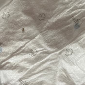 Sleepy Bio Natural Bebek Bezinin İlk Katmanından Sert Cisim Çıktı.