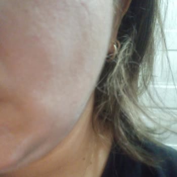 Bioderma Hassas Ciltler C Vitamini Serum