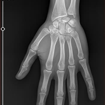 Sağlık Bakanlığı Sultangazi Haseki Egitim Ve Araştırma Hastanesi Ameliyat Sırası