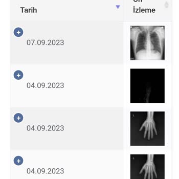 Sağlık Bakanlığı Sultangazi Haseki Egitim Ve Araştırma Hastanesi Ameliyat Sırası