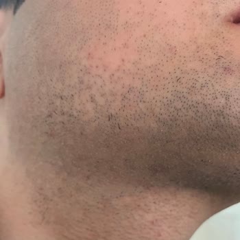 Braun Kişisel Bakım Ürünleri Braun S6 Tıraş Makinesi Çene Altını Almıyor