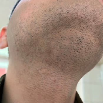 Braun Kişisel Bakım Ürünleri Braun S6 Tıraş Makinesi Çene Altını Almıyor