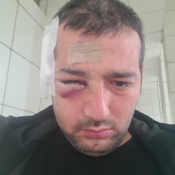 Şişli Hamidiye Etfal Eğitim ve Araştırma Hastanesi Plastik Cerrahi Bölümü