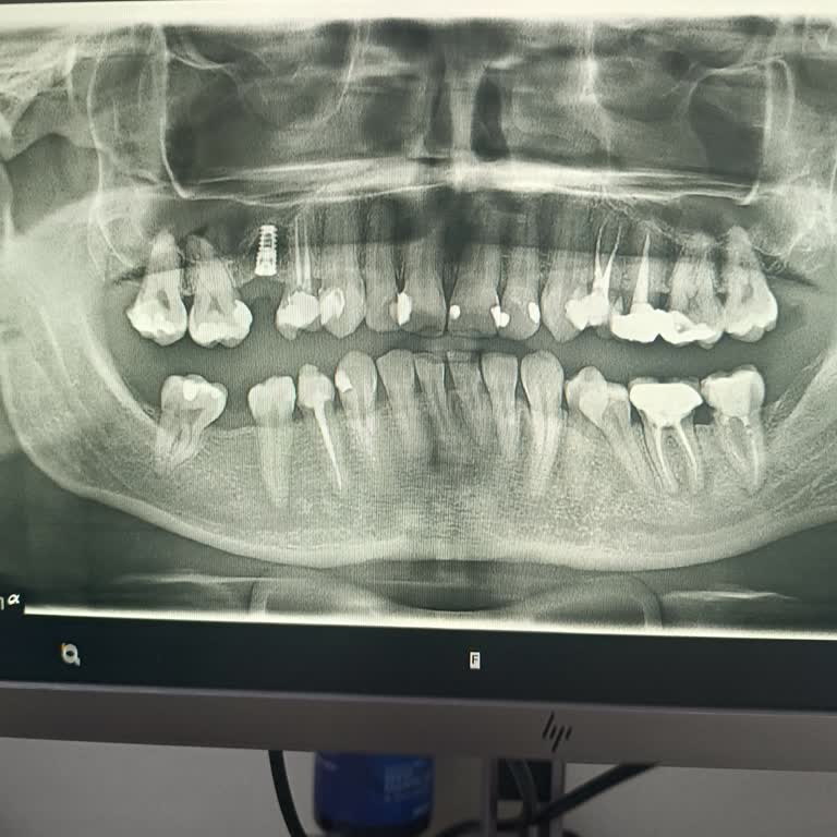 Egemen Esen Diş Kliniği 6 Yıl Önce Dişleri Yaptırdık Yeri Nerede