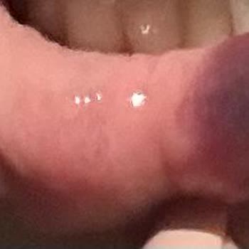 Didem Toktaş Beauty Güzellik Merkezinde Yaşanan Dudak Dolgusu Problemleri