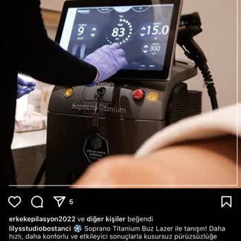 Lily's Beauty Studio Lazer Epilasyon Cihaz Sorunu