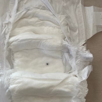 Sleepy Bebek Bezi İçinden Taş Çıktı