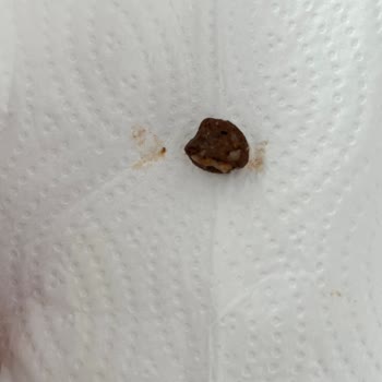 Superfresh Bezelyenin İçinden Kocaman Taş Çıktı