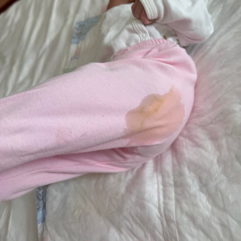 Sleepy Sızdıran Bebek Bezi