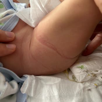 Baby Turco Bebek Bezi Aşırı Sıktı Ve Sızıntı Yaptı