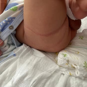 Baby Turco Bebek Bezi Aşırı Sıktı Ve Sızıntı Yaptı