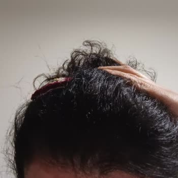 Gratis Acil Dönüş Sağlanmasını İstiyorum