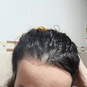 Gratis Acil Dönüş Sağlanmasını İstiyorum