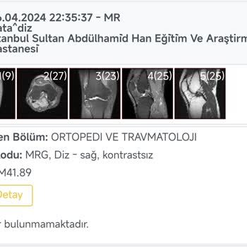 Sağlık Bakanlığı Eğitim Ve Araştırma Hastanesinde MR Sonuçları Gecikmesi Şikayeti