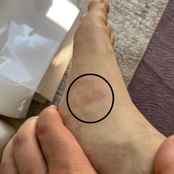 Superstep.com Üretim Hatalı Crocs Terlik Satıyor.