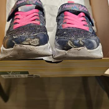Skechers 1 Haftada Deforme Oldu