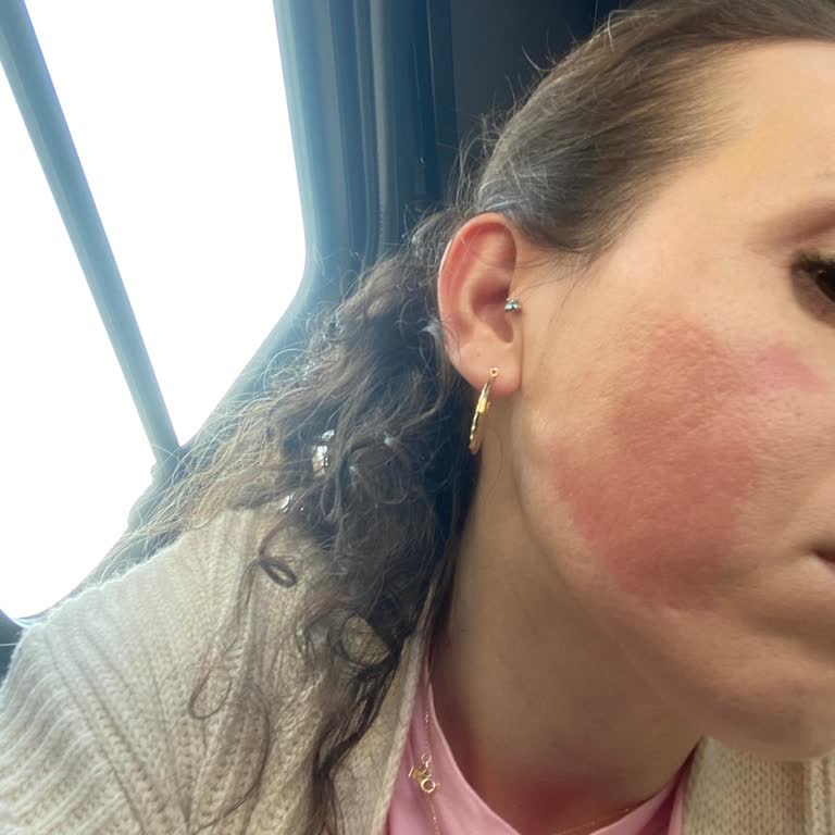 Woman Beauty Lounge Dermapen İşlemi Sorunu