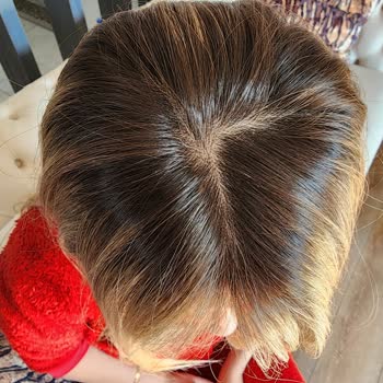 Doğan & Gökay Türkmenbaşı Saçlarıma Çok Zarar Verdi