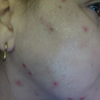 The Purest Solutions Purest C Vitamini Serum