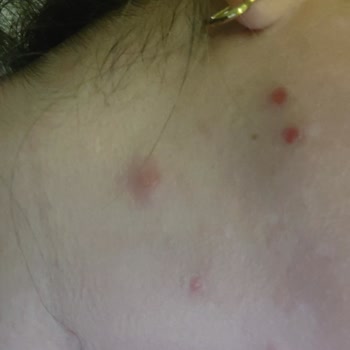 The Purest Solutions Purest C Vitamini Serum