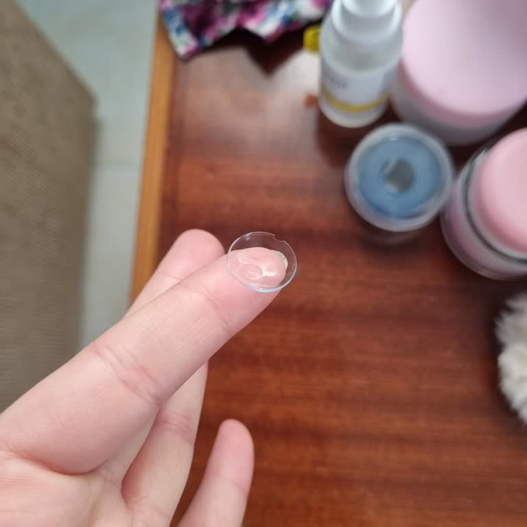 Acuvue Kontak Lens Yırtılıyor