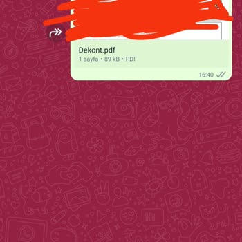 Avrupa Diş Polikliniği Diş Teli Ve Retainer Sorunu