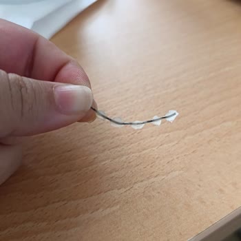 Avrupa Diş Polikliniği Diş Teli Ve Retainer Sorunu