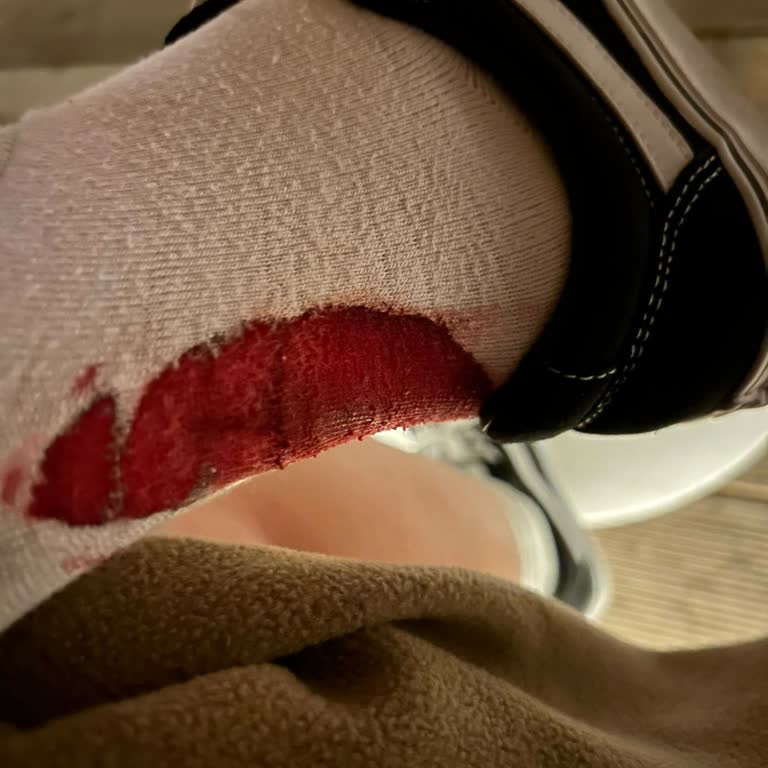 Adidas Saruhan Spor Çanakkale Vans Şikayet