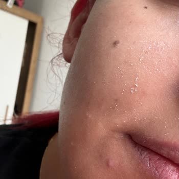 Maruderm Leke Karşıtı Güneş Kremi Döküldü