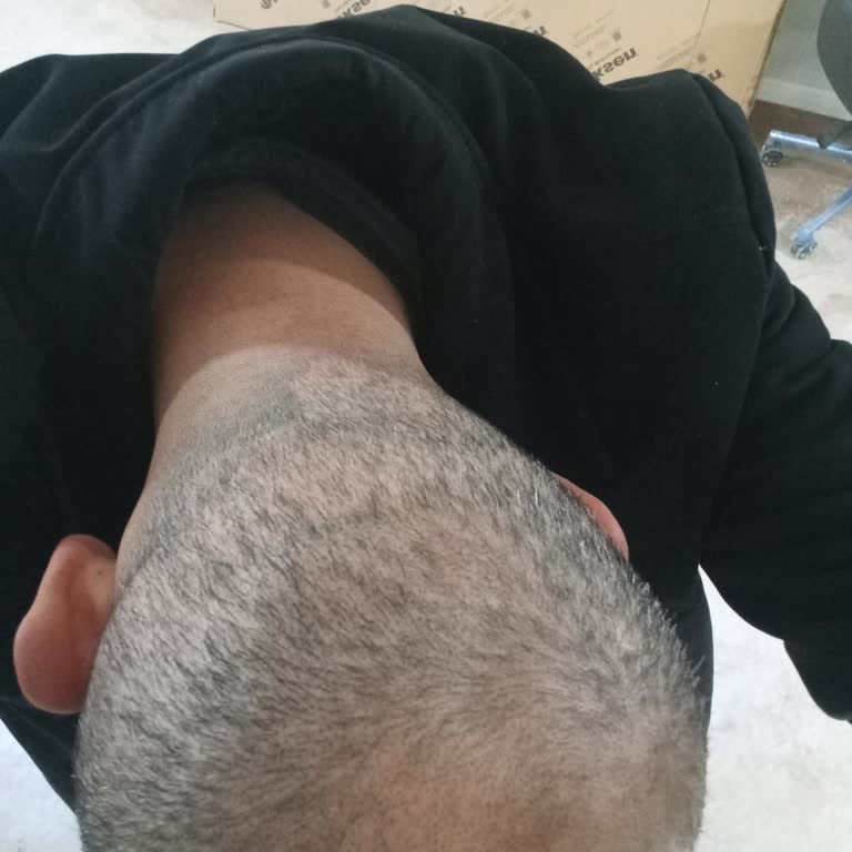 Arenamed Saç Ekimi Operasyonu Hakkında Tarafsız Değerlendirme