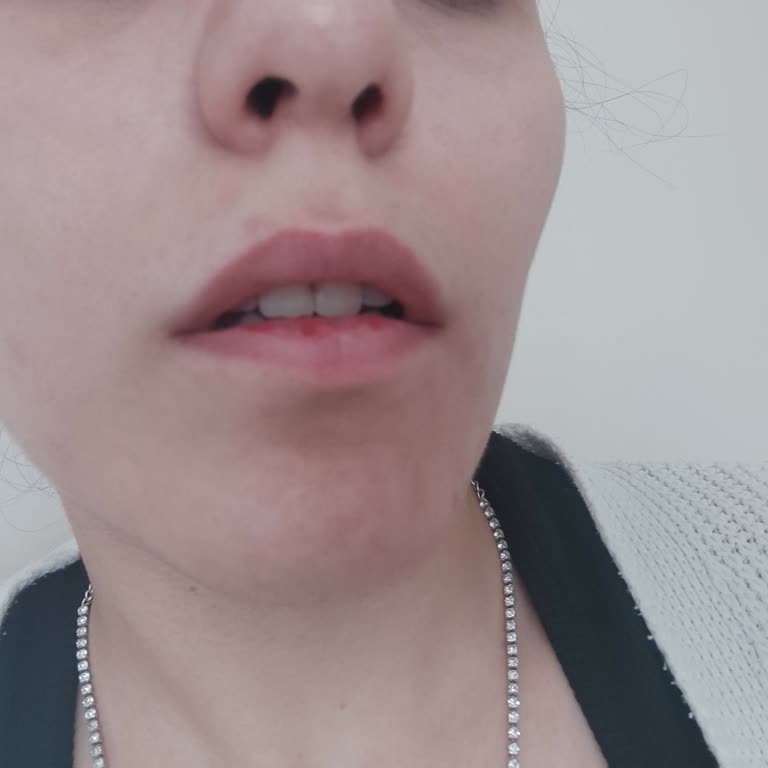 Maybelline New York Lifter Plump Dudak Parlatıcısı Dudağımı Kabarttı.