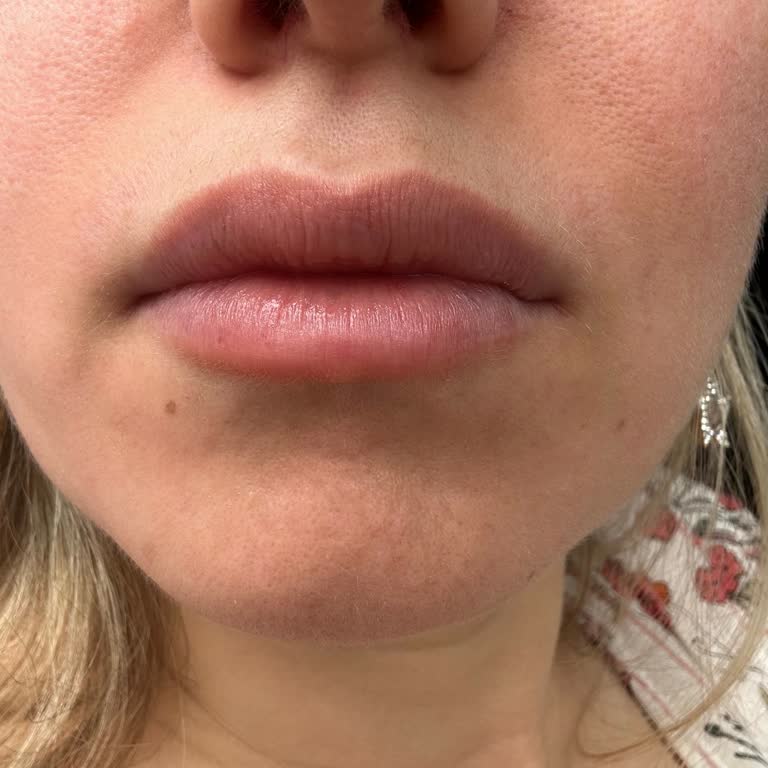 Dt. Emin Savaş Estetik Uygulamalarında Yaşanan Sorunlar