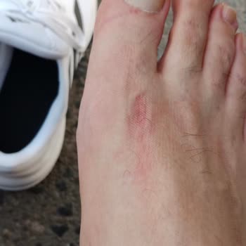 Adidas Marka Response Model Yürüyüş Ayakkabı Hatası