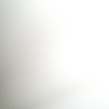 Renault Megane 4 Direksiyon Deforme Olması