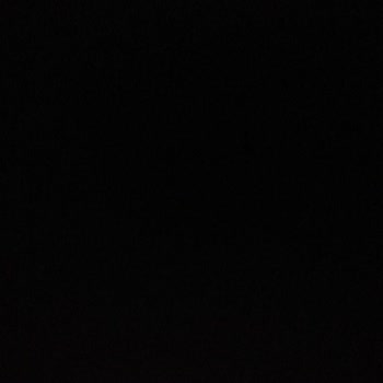 Renault Megane 4 Direksiyon Deforme Olması