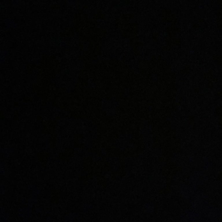 Dr. Hüseyin Tırman Polikliniği Dövme Sildirme Sabit Fiyat Olmasına Rağmen %400 Zam