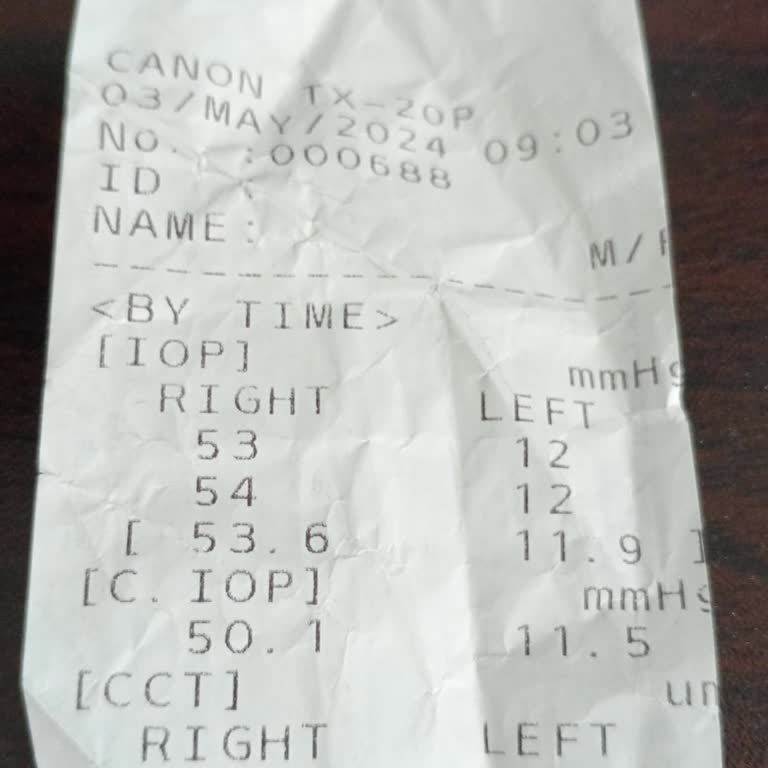 Hacettepe Üniversitesi Hastanesi Göz Hastalıkları Yüksek Göz Tansiyonu