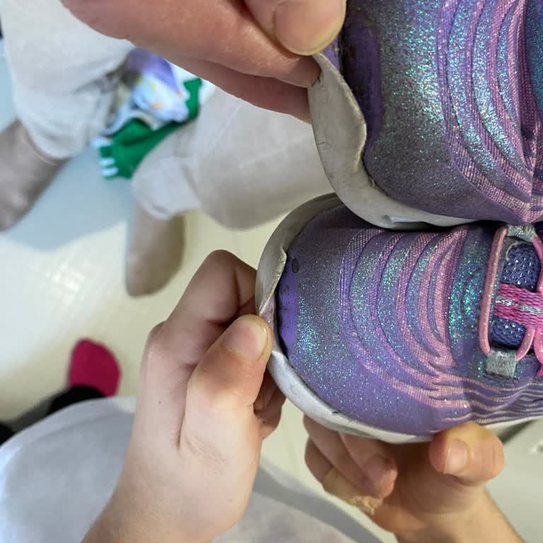 Skechers Çocuk Ayakkabısı Burun Açılması