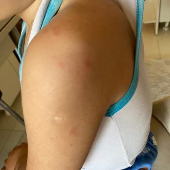 İburamin Zero Çocukları Zehirliyor!