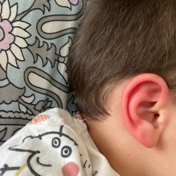 Argivit 2 Dakikada Olağanüstü Yan Etkiler Korkunç! Dikkat Hastanelik Ediyor