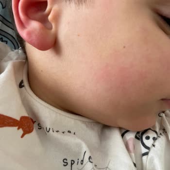 Argivit 2 Dakikada Olağanüstü Yan Etkiler Korkunç! Dikkat Hastanelik Ediyor