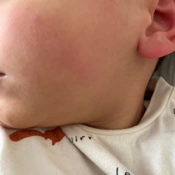 Argivit 2 Dakikada Olağanüstü Yan Etkiler Korkunç! Dikkat Hastanelik Ediyor