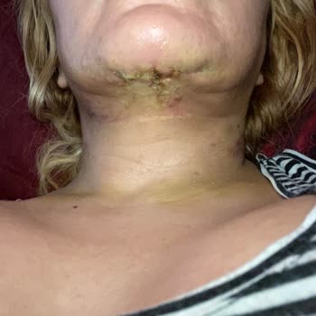 Medistanbul Hastanesi Hastane Cerrahi İşlemleri Ve Hasta Memnuniyeti Üzerine Değerlendirme