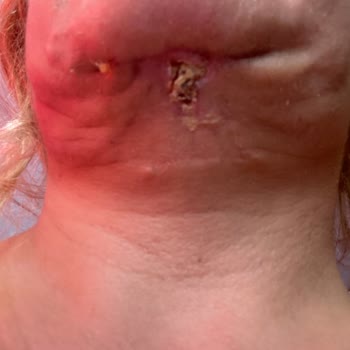 Medistanbul Hastanesi Hastane Cerrahi İşlemleri Ve Hasta Memnuniyeti Üzerine Değerlendirme