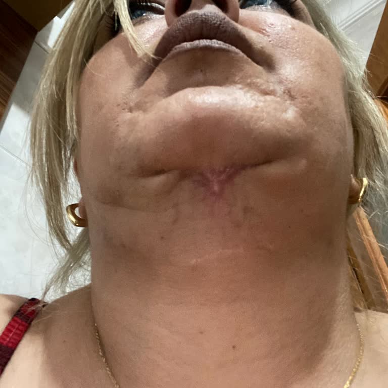 Medistanbul Hastanesi Hastane Cerrahi İşlemleri Ve Hasta Memnuniyeti Üzerine Değerlendirme