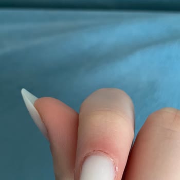 Berna Nail Halkalı Parmağım İltihap Kaptı Hijyen 0